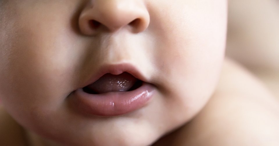 Bebeklerde dudak bagi nedenleri