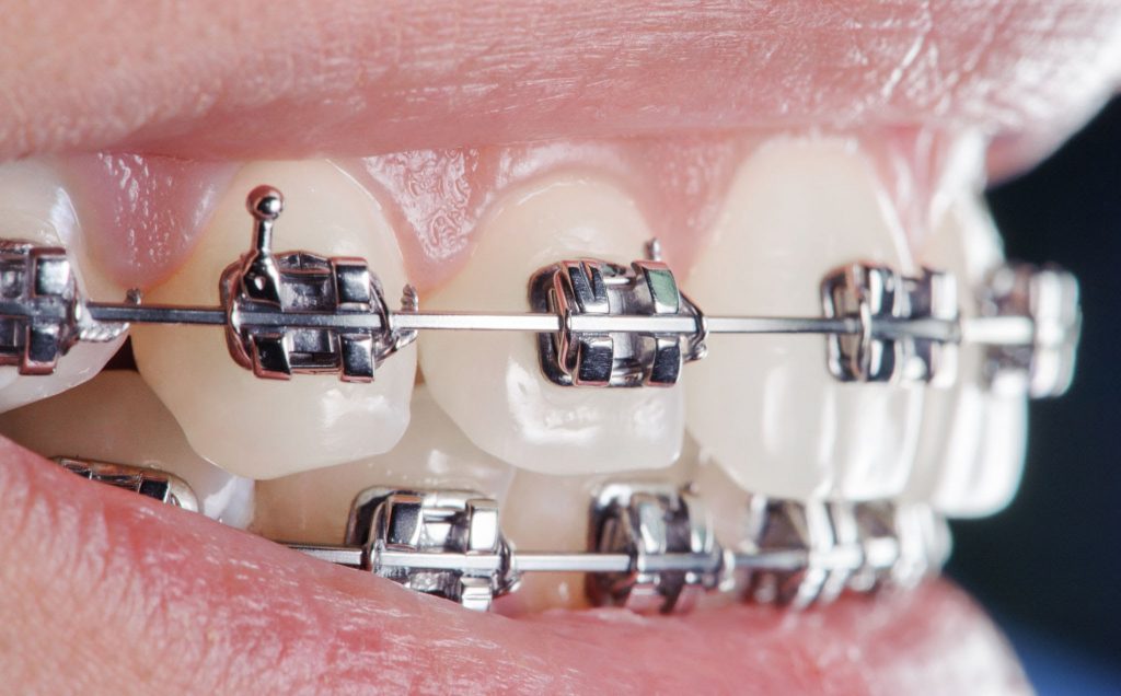 Ortodontik