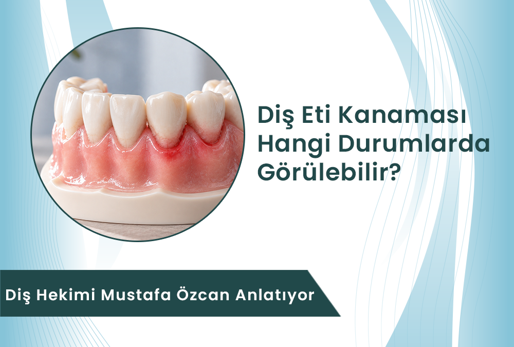 Diş eti kanamasının olası nedenlerini temsil eden diş ve diş eti modeli